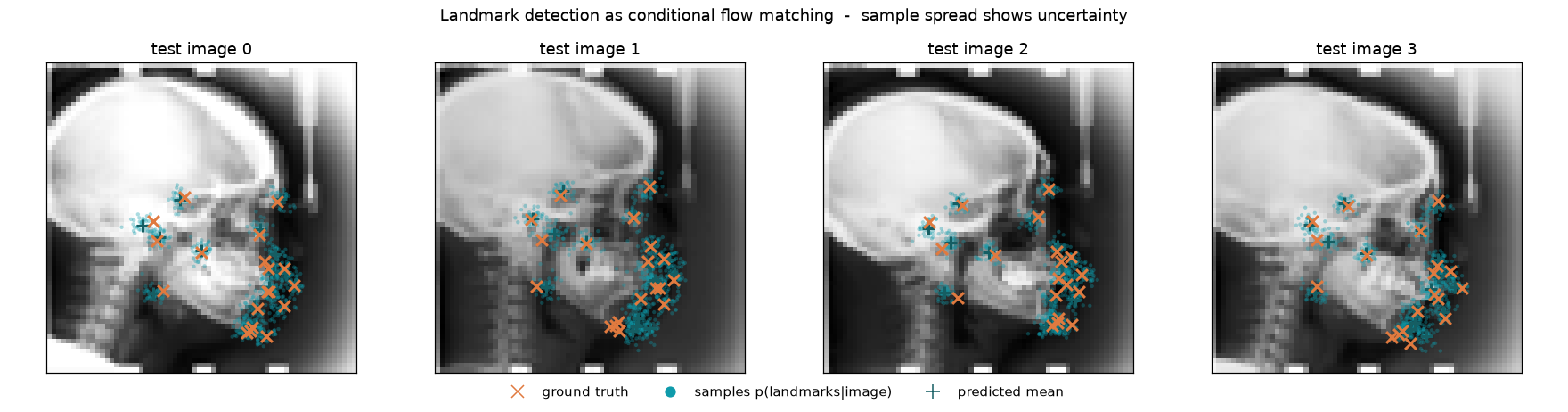 Landmark detection on held-out cephalometric X-rays